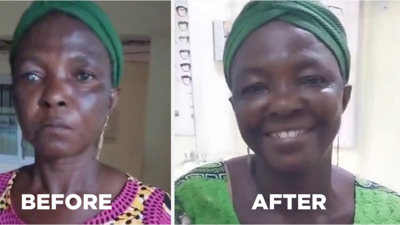 From Darkness to Light- A Journey of Sight and Strength - BATIEKA HOSPITAL